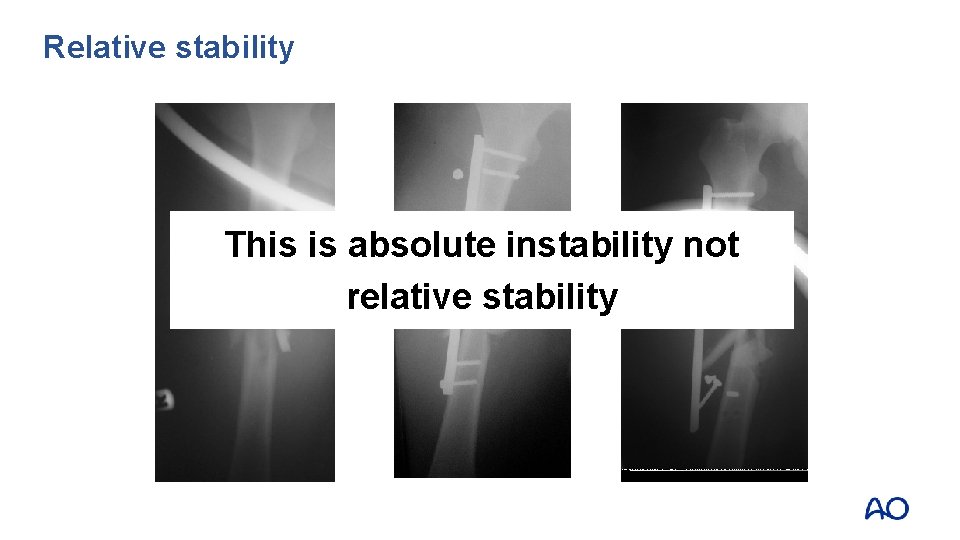 Relative stability This is absolute instability not relative stability 