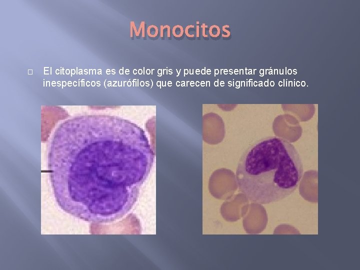 Monocitos � El citoplasma es de color gris y puede presentar gránulos inespecíficos (azurófilos)