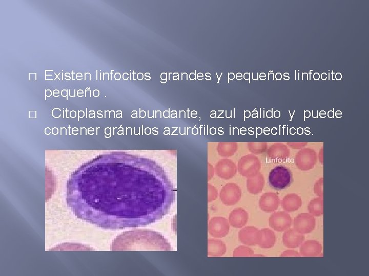 � � Existen linfocitos grandes y pequeños linfocito pequeño. Citoplasma abundante, azul pálido y