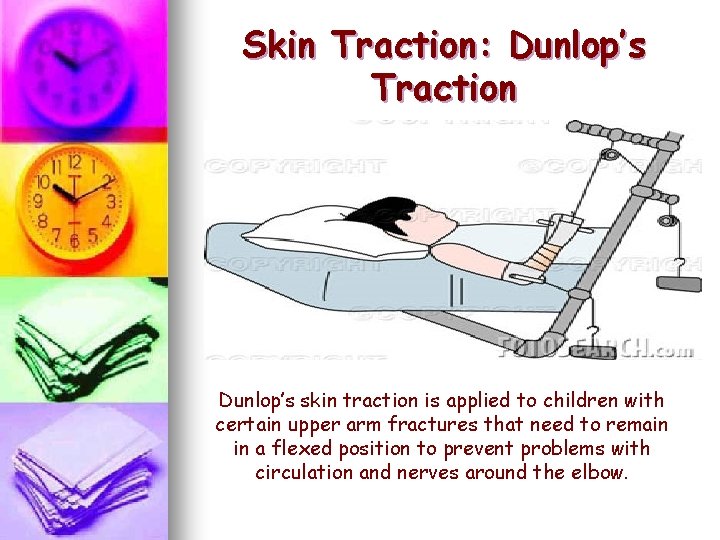 Skin Traction: Dunlop’s Traction Dunlop’s skin traction is applied to children with certain upper