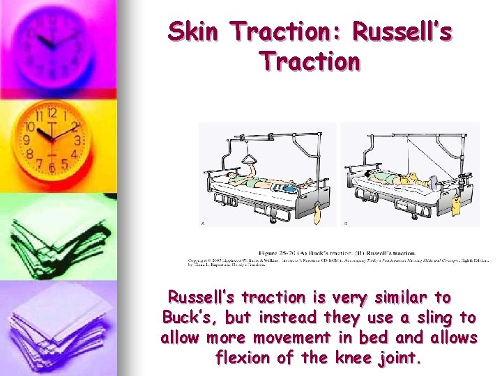 Skin Traction: Russell’s Traction Russell’s traction is very similar to Buck’s, but instead they