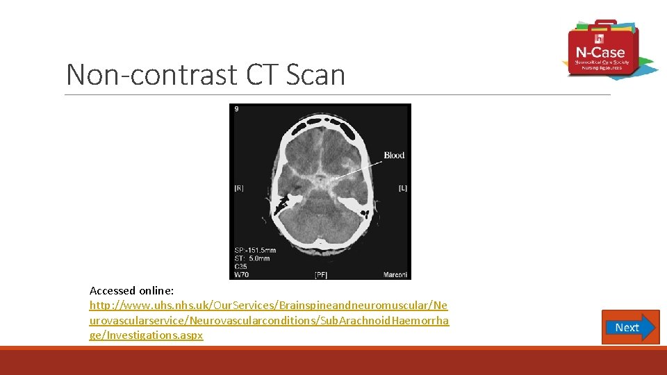 Non-contrast CT Scan Accessed online: http: //www. uhs. nhs. uk/Our. Services/Brainspineandneuromuscular/Ne urovascularservice/Neurovascularconditions/Sub. Arachnoid. Haemorrha