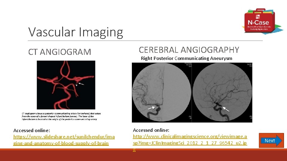 Vascular Imaging CT ANGIOGRAM Accessed online: https: //www. slideshare. net/sunilchendur/ima ging-and-anatomy-of-blood-supply-of-brain CEREBRAL ANGIOGRAPHY Right