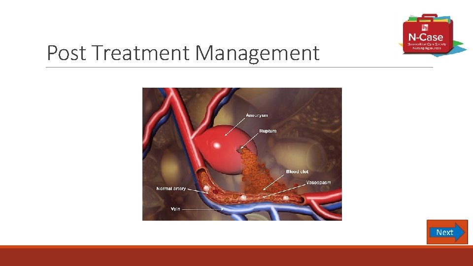 Post Treatment Management 