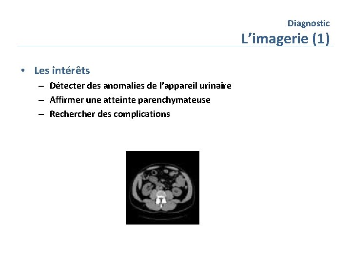 Diagnostic L’imagerie (1) • Les intérêts – Détecter des anomalies de l’appareil urinaire –