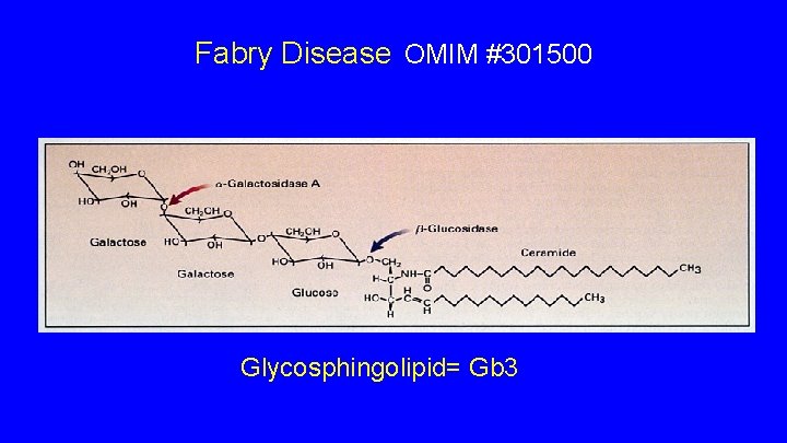 Fabry Disease OMIM #301500 Glycosphingolipid= Gb 3 Fabry Disease OMIM #301500 Glycosphingolipid= Gb 3