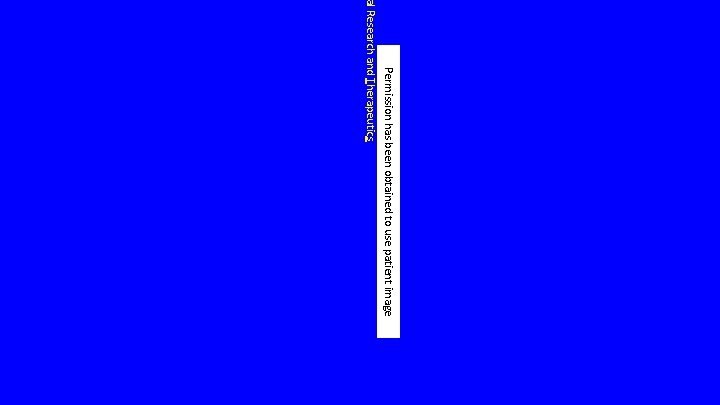 Permission has been obtained to use patient image al Research and Therapeutics Permission has been obtained to use patient image al Research and Therapeutics