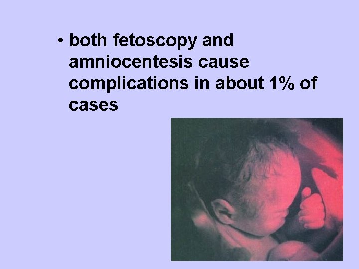  • both fetoscopy and amniocentesis cause complications in about 1% of cases 