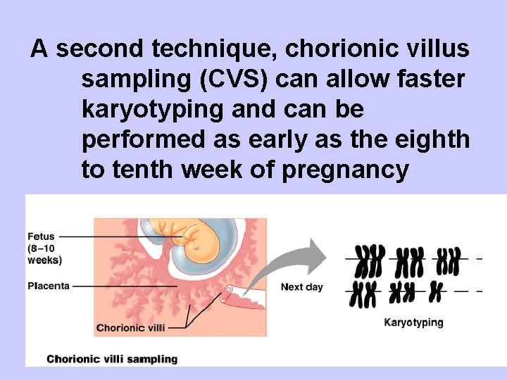 A second technique, chorionic villus sampling (CVS) can allow faster karyotyping and can be