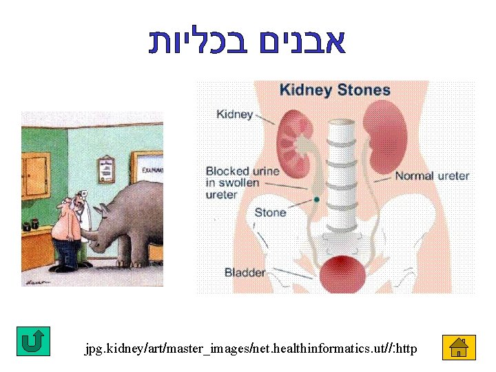 jpg. kidney/art/master_images/net. healthinformatics. ut//: http 