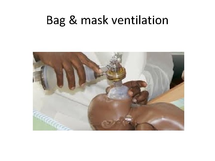 Bag & mask ventilation 