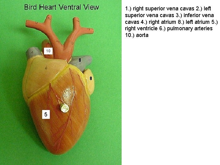 1. ) right superior vena cavas 2. ) left superior vena cavas 3. )