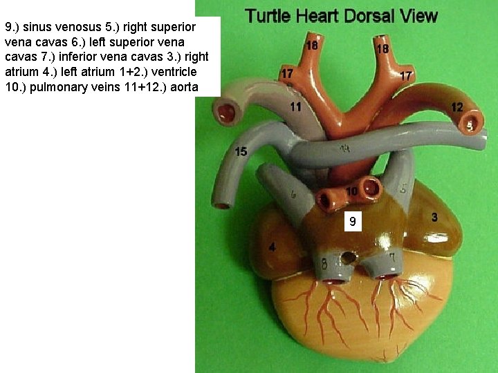 9. ) sinus venosus 5. ) right superior vena cavas 6. ) left superior
