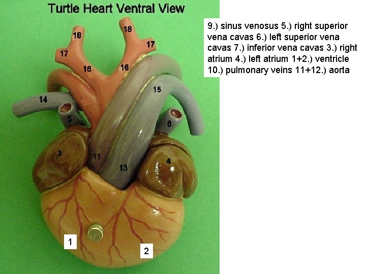 9. ) sinus venosus 5. ) right superior vena cavas 6. ) left superior