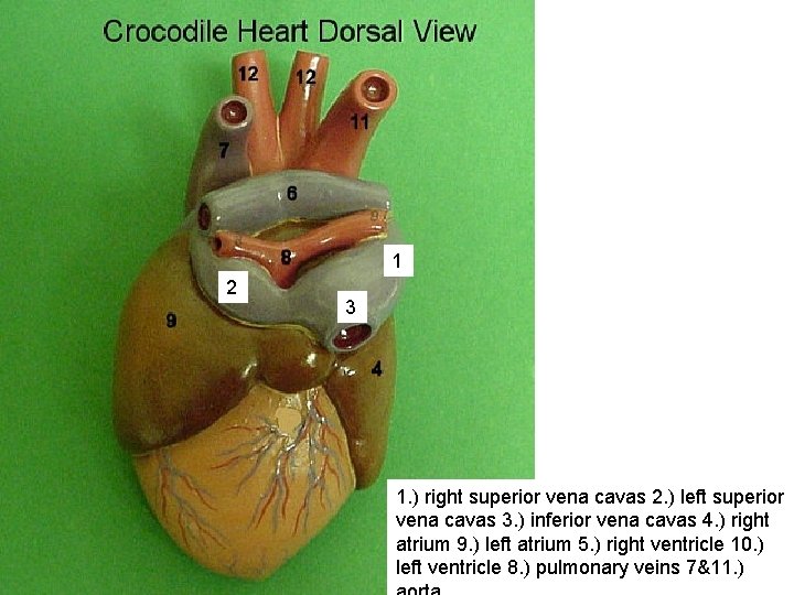 1 2 3 1. ) right superior vena cavas 2. ) left superior vena
