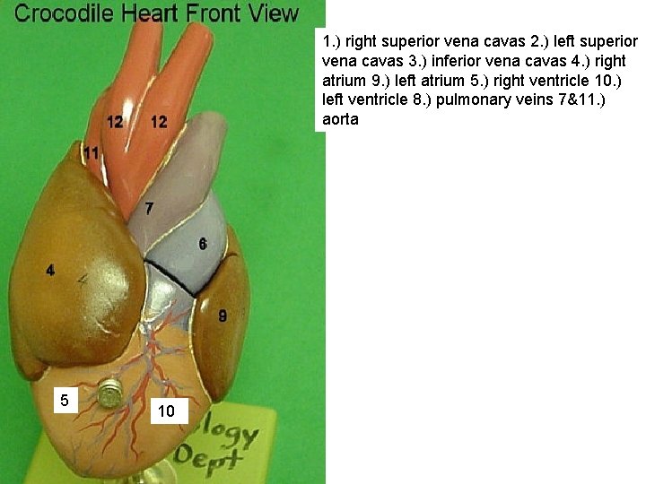 1. ) right superior vena cavas 2. ) left superior vena cavas 3. )