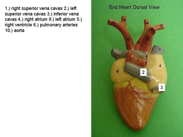 1. ) right superior vena cavas 2. ) left superior vena cavas 3. )