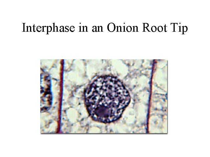 Interphase in an Onion Root Tip 