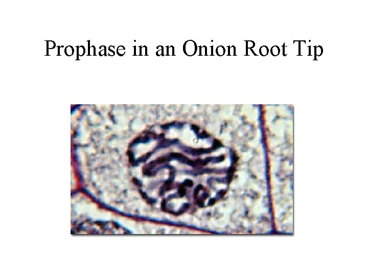 Prophase in an Onion Root Tip 