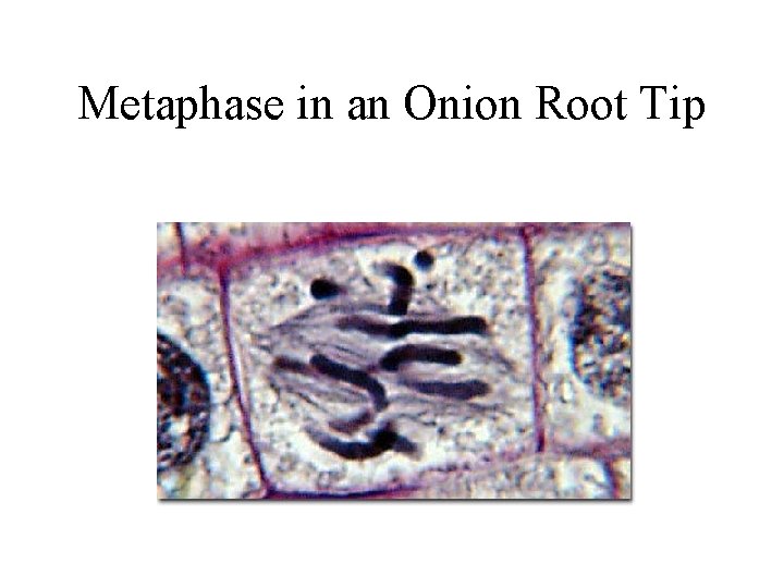 Metaphase in an Onion Root Tip 