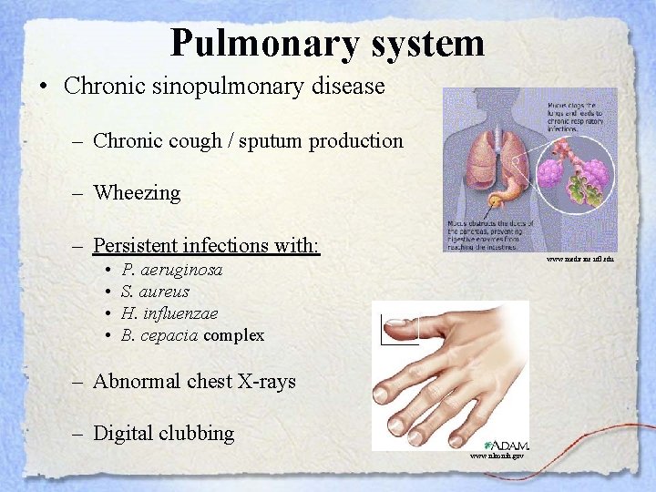 Pulmonary system • Chronic sinopulmonary disease – Chronic cough / sputum production – Wheezing