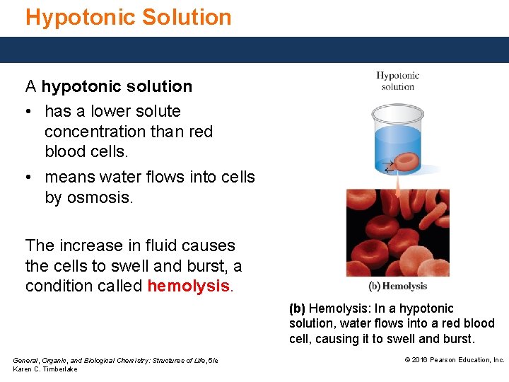 Hypotonic Solution A hypotonic solution • has a lower solute concentration than red blood