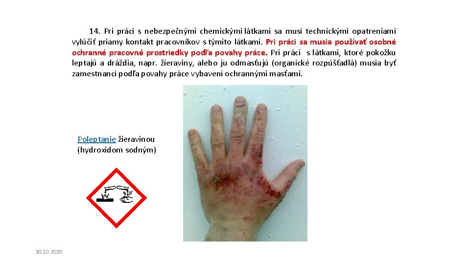 14. Pri práci s nebezpečnými chemickými látkami sa musí technickými opatreniami vylúčiť priamy kontakt 14. Pri práci s nebezpečnými chemickými látkami sa musí technickými opatreniami vylúčiť priamy kontakt
