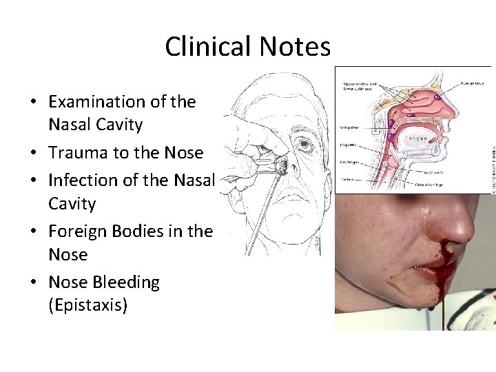 Clinical Notes • Examination of the Nasal Cavity • Trauma to the Nose •