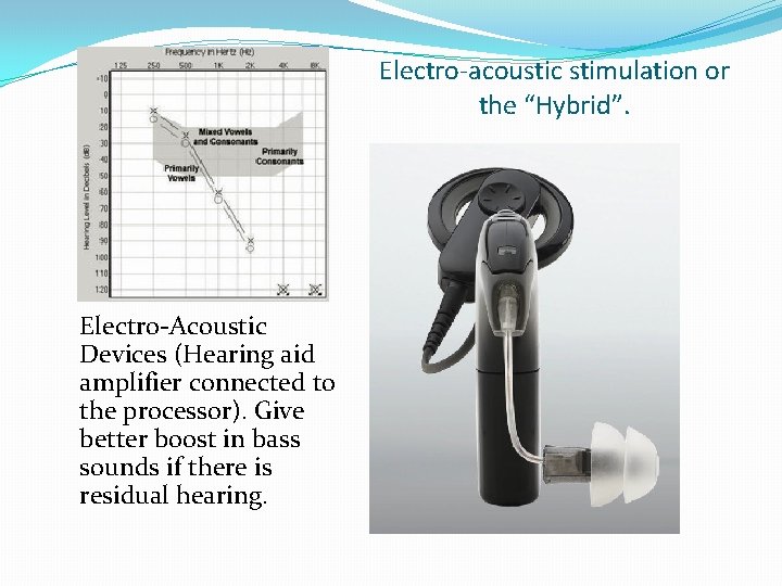 Electro-acoustic stimulation or the “Hybrid”. Electro-Acoustic Devices (Hearing aid amplifier connected to the processor).