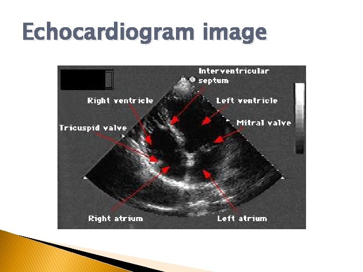 Echocardiogram image Echocardiogram image