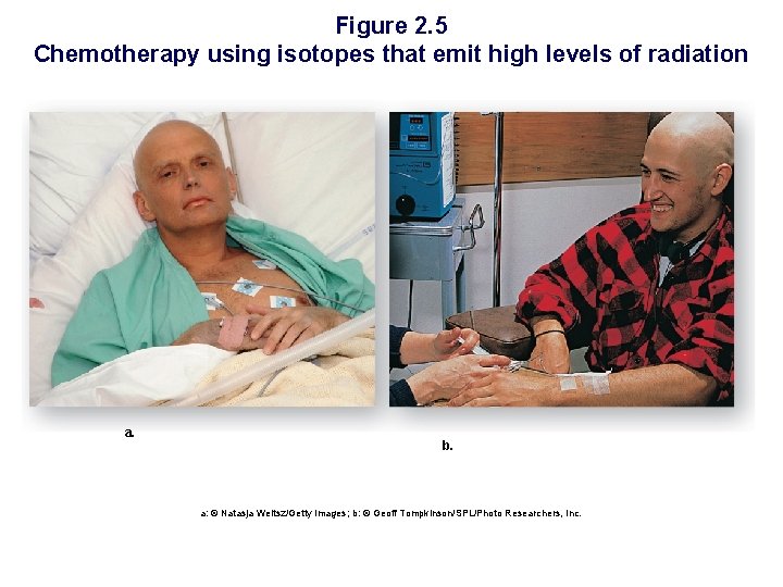 Figure 2. 5 Chemotherapy using isotopes that emit high levels of radiation a. b.