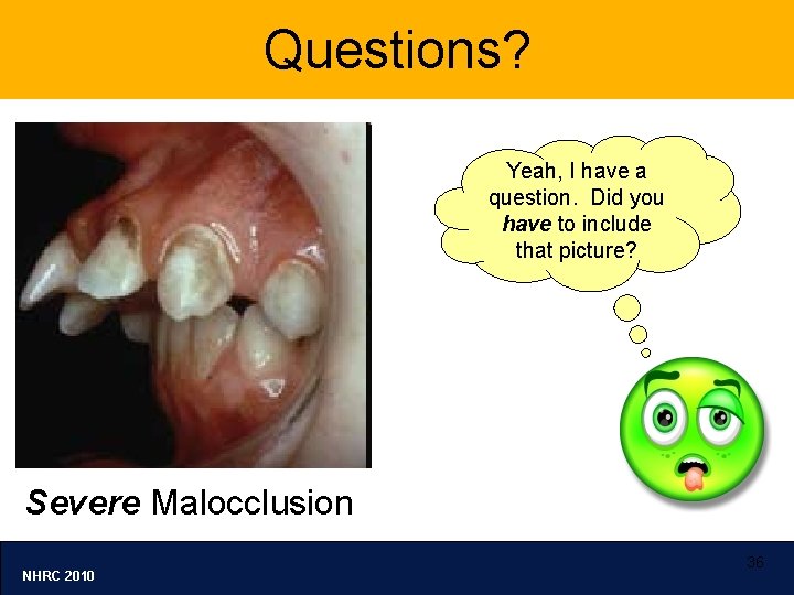 Questions? Yeah, I have a question. Did you have to include that picture? Severe