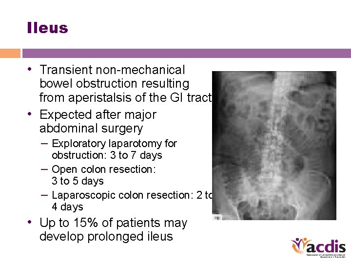 Ileus • Transient non-mechanical bowel obstruction resulting from aperistalsis of the GI tract •