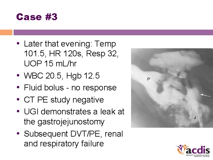Case #3 • Later that evening: Temp • • • 101. 5, HR 120