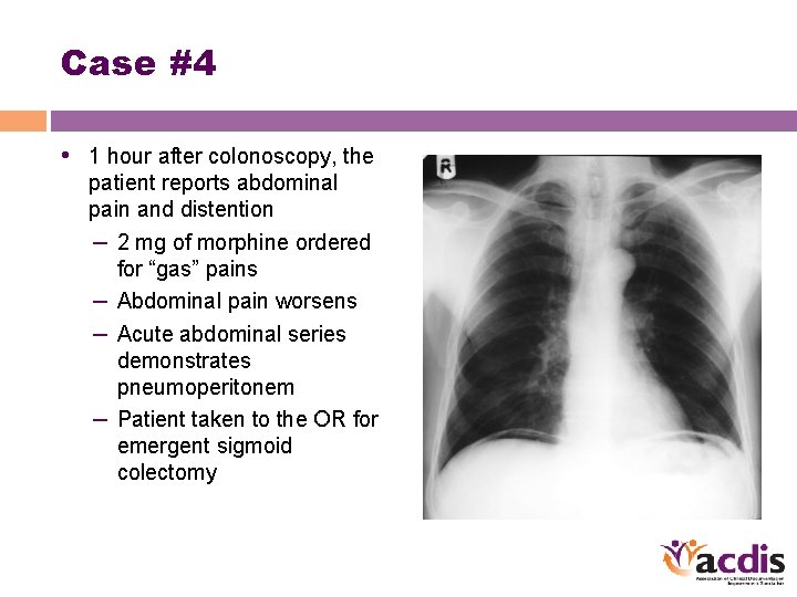 Case #4 • 1 hour after colonoscopy, the patient reports abdominal pain and distention