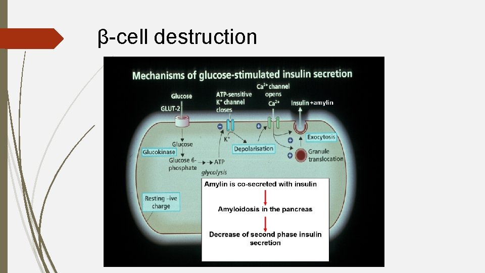 β-cell destruction 