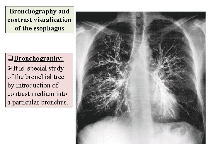 Bronchography and contrast visualization of the esophagus q. Bronchography; ØIt is special study of