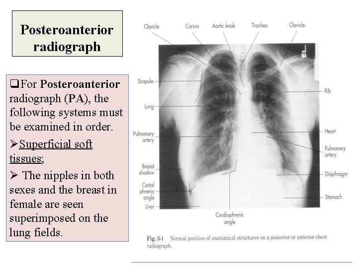 Posteroanterior radiograph q. For Posteroanterior radiograph (PA), the following systems must be examined in