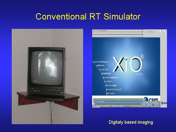 Conventional RT Simulator Digitaly based imaging 