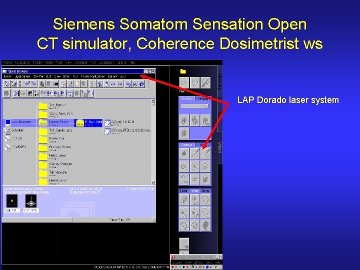 Siemens Somatom Sensation Open CT simulator, Coherence Dosimetrist ws LAP Dorado laser system 