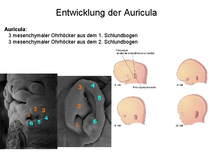 Entwicklung der Auricula: 3 mesenchymaler Ohrhöcker aus dem 1. Schlundbogen 3 mesenchymaler Ohrhöcker aus