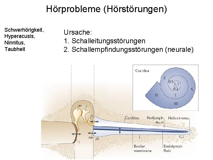 Hörprobleme (Hörstörungen) Schwerhörigkeit, Hyperacusis, Ninnitus, Taubheit Ursache: 1. Schalleitungsstörungen 2. Schallempfindungsstörungen (neurale) 