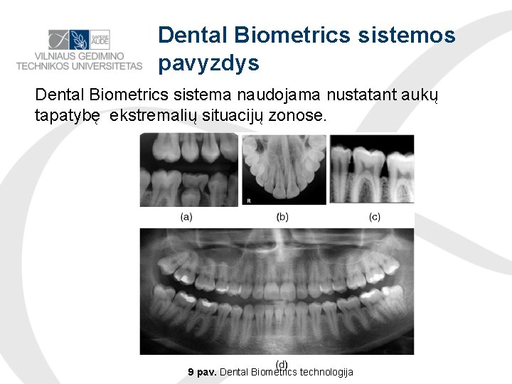 Dental Biometrics sistemos pavyzdys Dental Biometrics sistema naudojama nustatant aukų tapatybę ekstremalių situacijų zonose.