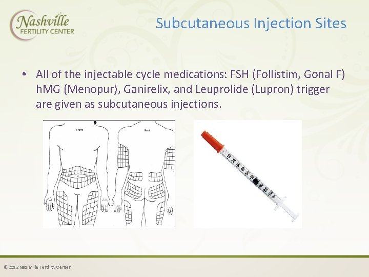 Subcutaneous Injection Sites • All of the injectable cycle medications: FSH (Follistim, Gonal F)