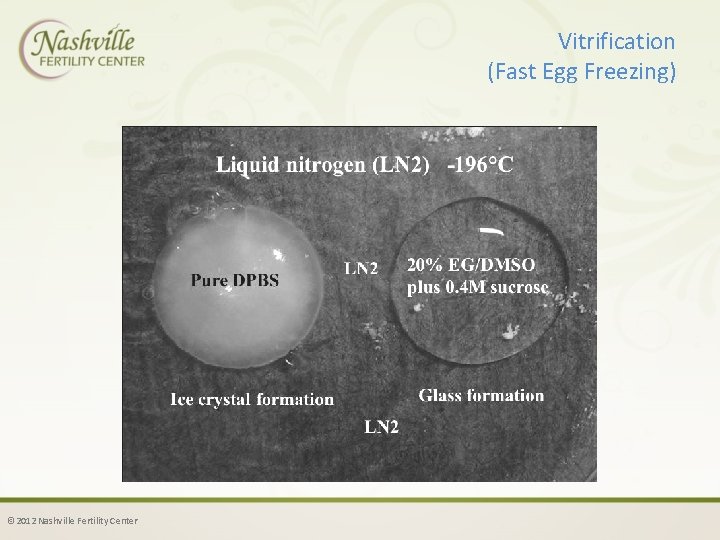 Vitrification (Fast Egg Freezing) © 2012 Nashville Fertility Center 