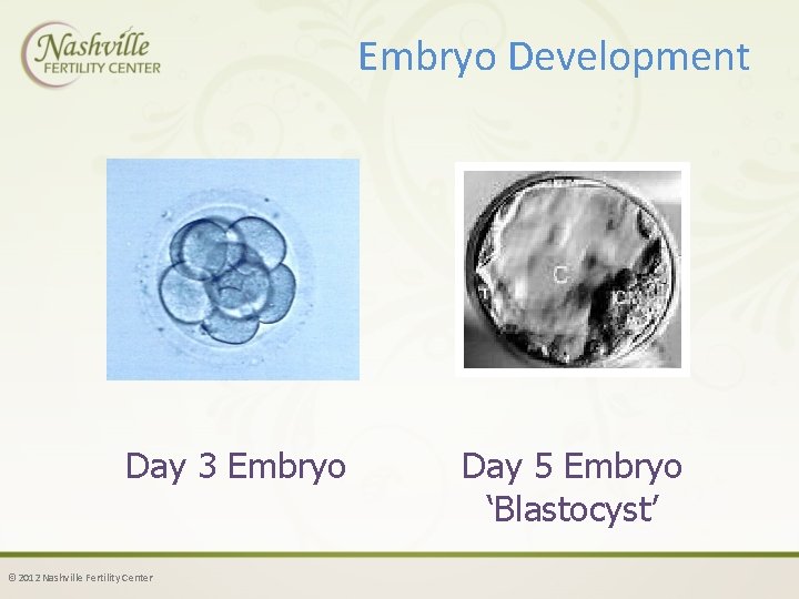 Embryo Development Day 3 Embryo © 2012 Nashville Fertility Center Day 5 Embryo ‘Blastocyst’