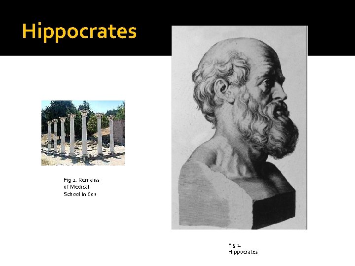 Hippocrates Fig 2. Remains of Medical School in Cos Fig 1. Hippocrates 