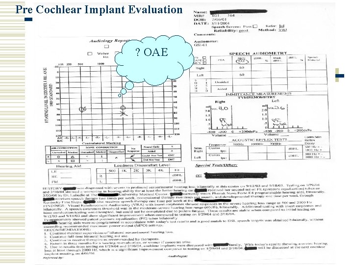 Pre Cochlear Implant Evaluation ? OAE 