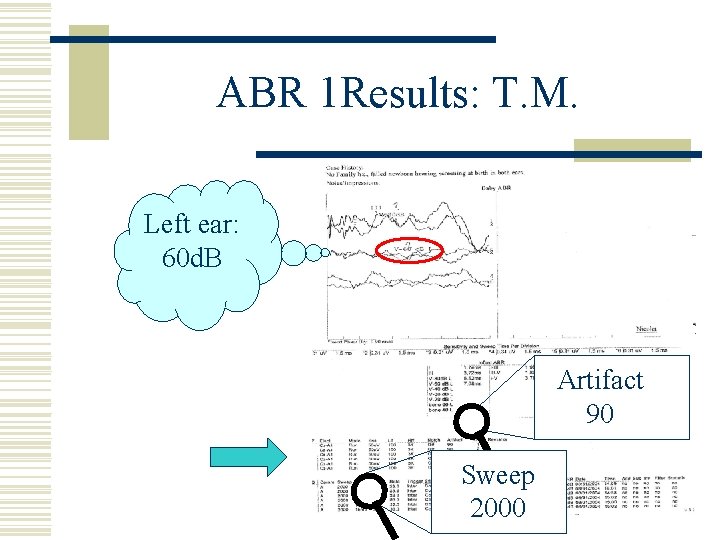 ABR 1 Results: T. M. Left ear: 60 d. B Artifact 90 Sweep 2000