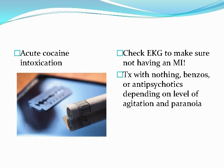 �Acute cocaine intoxication �Check EKG to make sure not having an MI! �Tx with